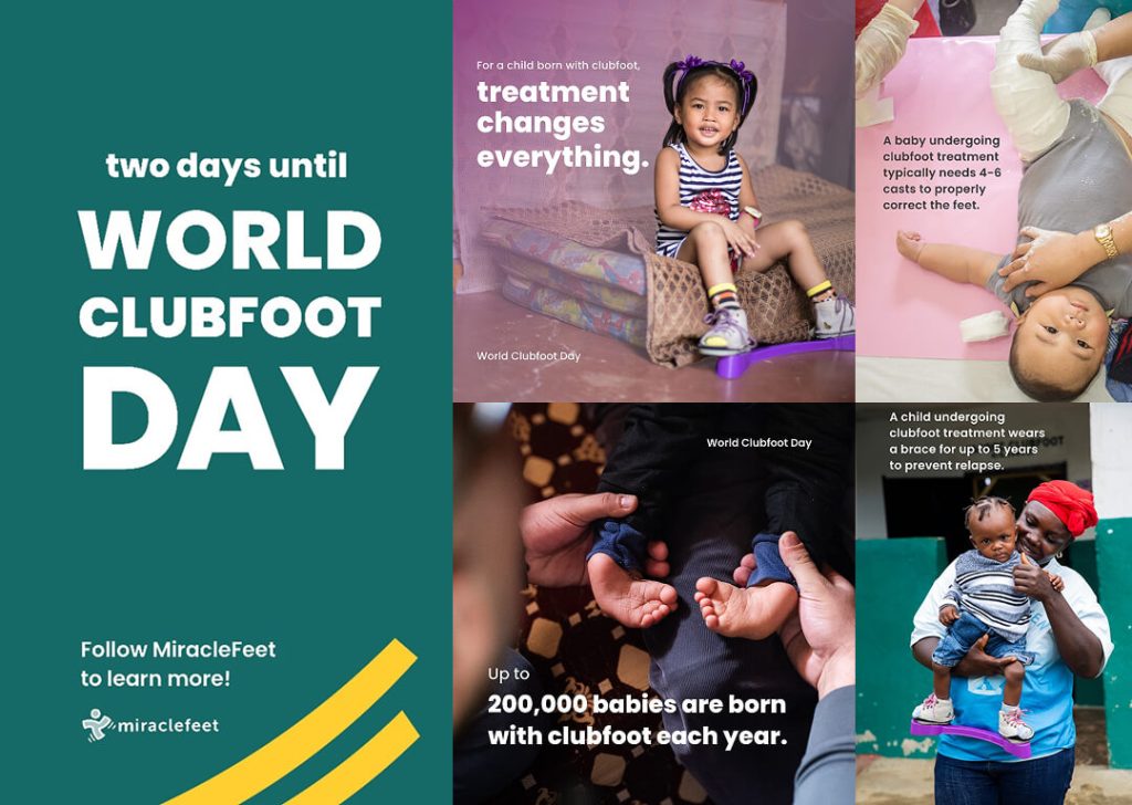 World Clubfoot Day 2025: Ensuring Every Child Has Access to Treatment and a Brighter Future